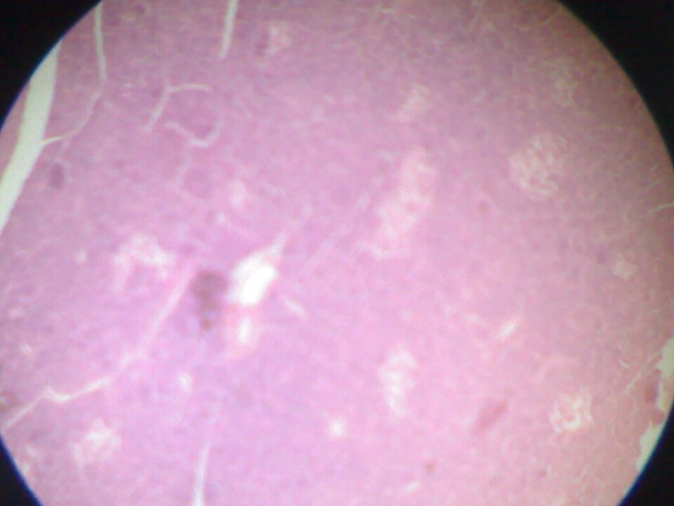 胰腺真实图片